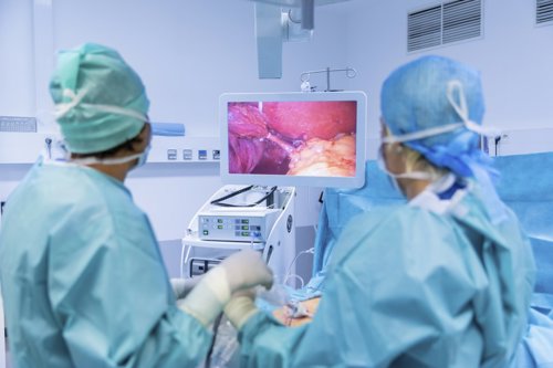 Medisch personeel voert een operatie uit met behulp van laparoscopische apparatuur